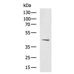 HCAR2 rabbit polyclonal antibody