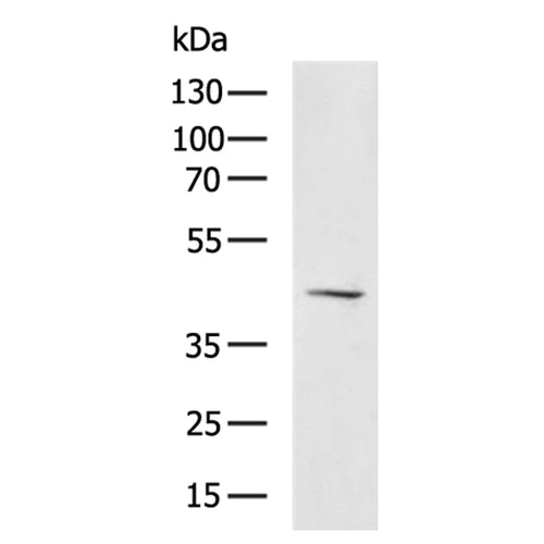 HCAR2 rabbit polyclonal antibody