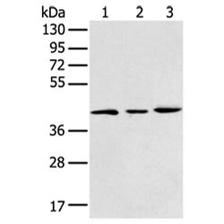 DCX rabbit polyclonal antibody