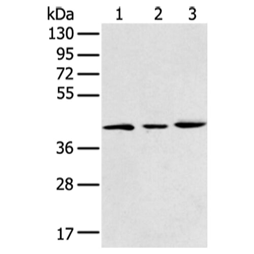 DCX rabbit polyclonal antibody