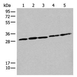 CITED1 rabbit polyclonal antibody