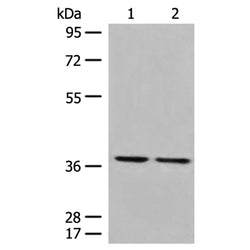 TNFSF11 rabbit polyclonal antibody