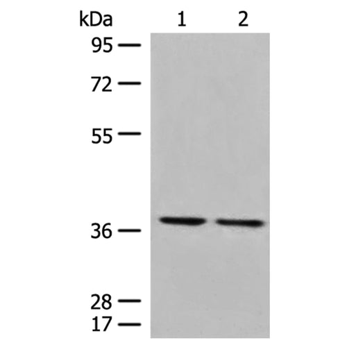TNFSF11 rabbit polyclonal antibody