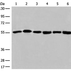 ALDH7A1 rabbit polyclonal antibody