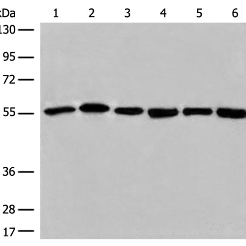 ALDH7A1 rabbit polyclonal antibody