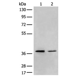 MBD2 rabbit polyclonal antibody