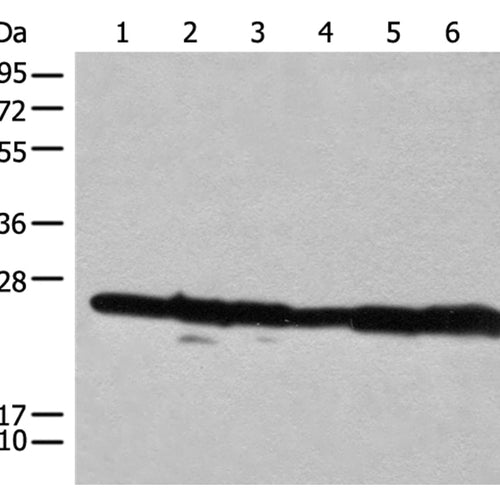 RPL14 rabbit polyclonal antibody