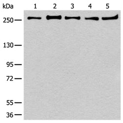 PRPF8 rabbit polyclonal antibody