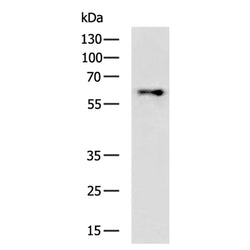 CGAS rabbit polyclonal antibody