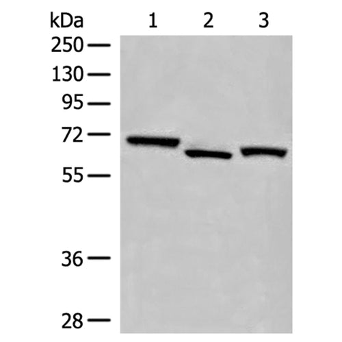 EEPD1 rabbit polyclonal antibody
