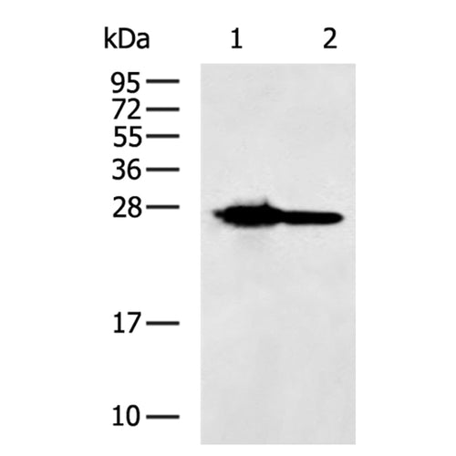 EFHD2 rabbit polyclonal antibody