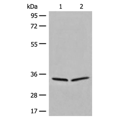 DIMT1 rabbit polyclonal antibody