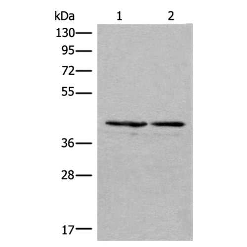 PNKD rabbit polyclonal antibody