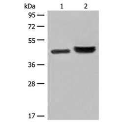 INPP1 rabbit polyclonal antibody