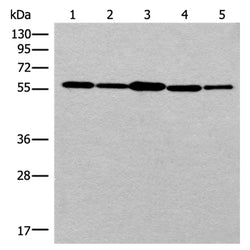 RAD23B rabbit polyclonal antibody