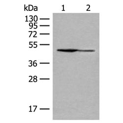GDI2 rabbit polyclonal antibody