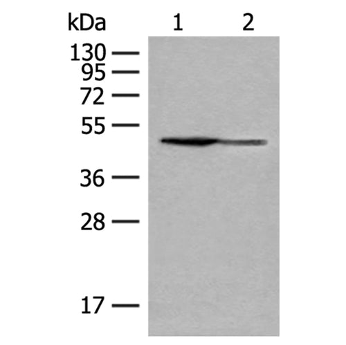 GDI2 rabbit polyclonal antibody