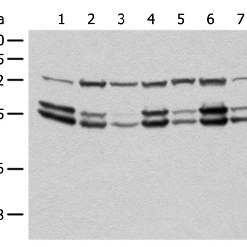 SHC1 rabbit polyclonal antibody