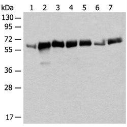 CCDC47 rabbit polyclonal antibody