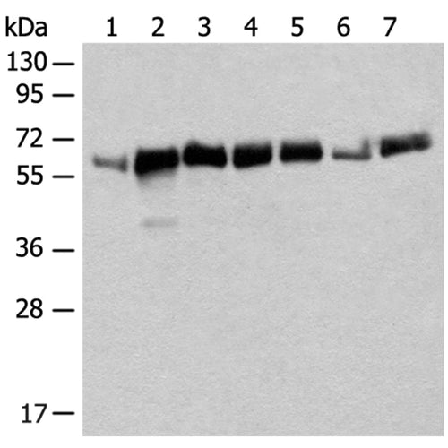 CCDC47 rabbit polyclonal antibody