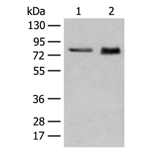 GTF2F1 rabbit polyclonal antibody