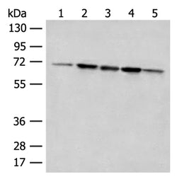 ACSF2 rabbit polyclonal antibody