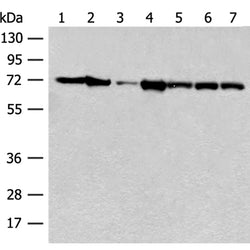 HSPA2 rabbit polyclonal antibody