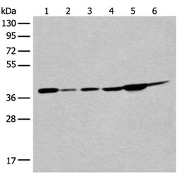 EIF2S1 rabbit polyclonal antibody