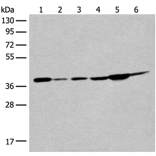 EIF2S1 rabbit polyclonal antibody