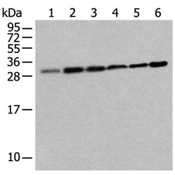 EIF3J rabbit polyclonal antibody