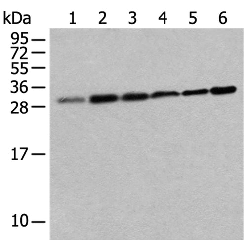 EIF3J rabbit polyclonal antibody