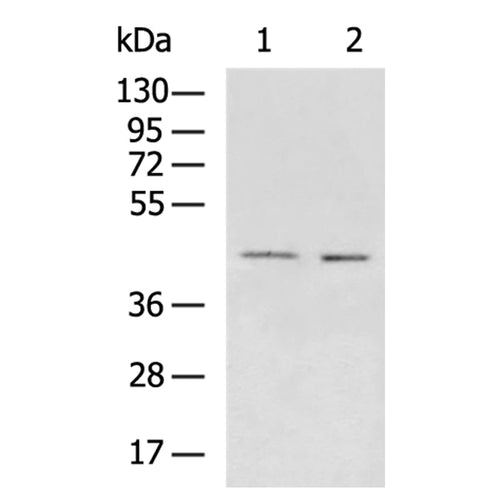 EME2 rabbit polyclonal antibody