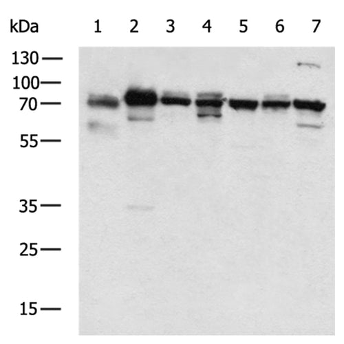 AFP rabbit polyclonal antibody