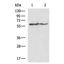 KRT6A rabbit polyclonal antibody