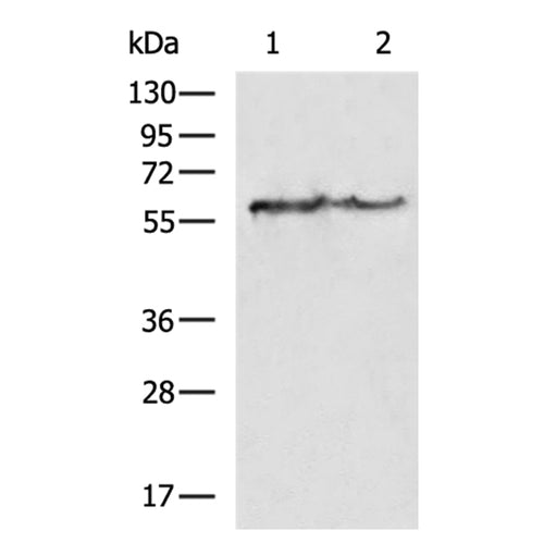 KRT6A rabbit polyclonal antibody