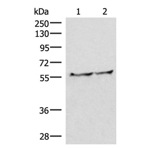 VIM rabbit polyclonal antibody