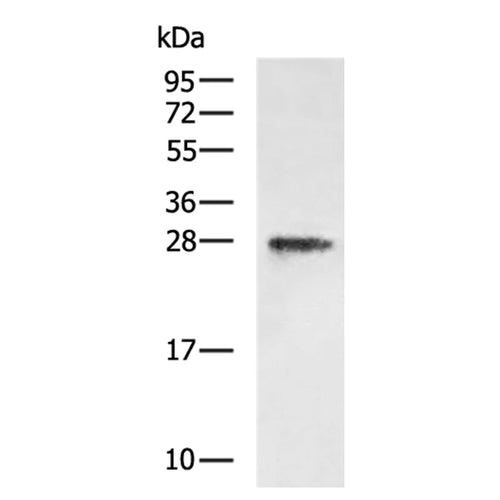 TNNI3 rabbit polyclonal antibody