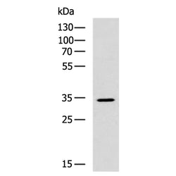 CLEC10A rabbit polyclonal antibody