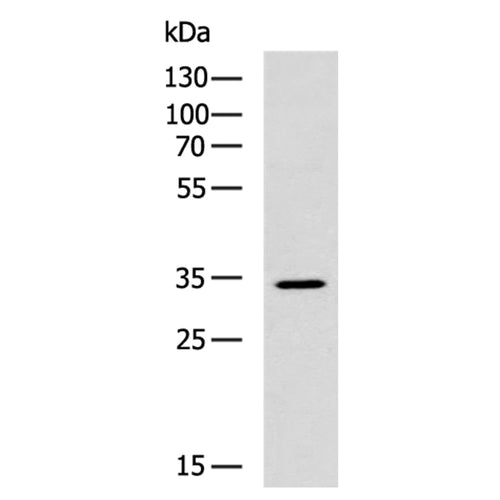 CLEC10A rabbit polyclonal antibody
