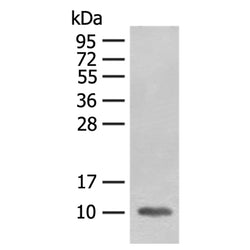 FABP4 rabbit polyclonal antibody