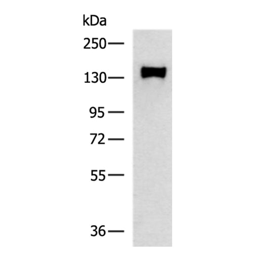 OGA rabbit polyclonal antibody