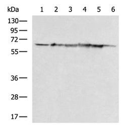 HSPD1 rabbit polyclonal antibody