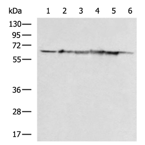 HSPD1 rabbit polyclonal antibody