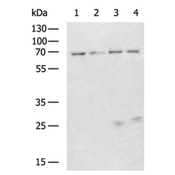 IGF2BP3 rabbit polyclonal antibody