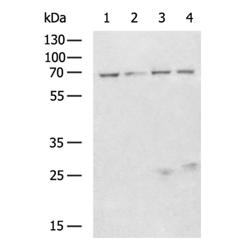 IGF2BP3 rabbit polyclonal antibody