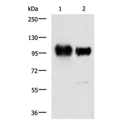 ITGB3 rabbit polyclonal antibody