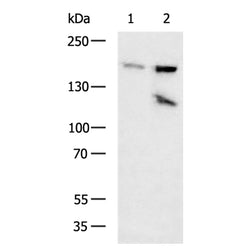 MSH6 rabbit polyclonal antibody