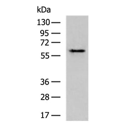 OCLN rabbit polyclonal antibody