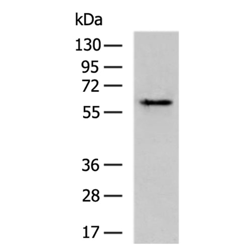 OCLN rabbit polyclonal antibody