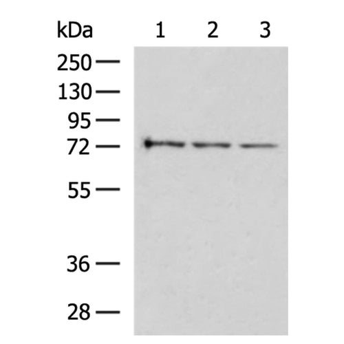 TP73 rabbit polyclonal antibody